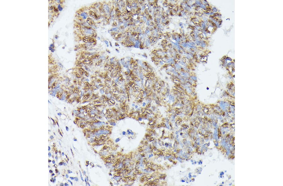 Immunohistochemistry - Anti-KIF22 Antibody (A91079) - Antibodies.com