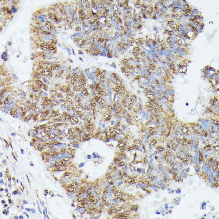 Immunohistochemistry - Anti-KIF22 Antibody (A91079) - Antibodies.com