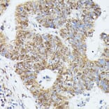 Immunohistochemistry - Anti-KIF22 Antibody (A91079) - Antibodies.com