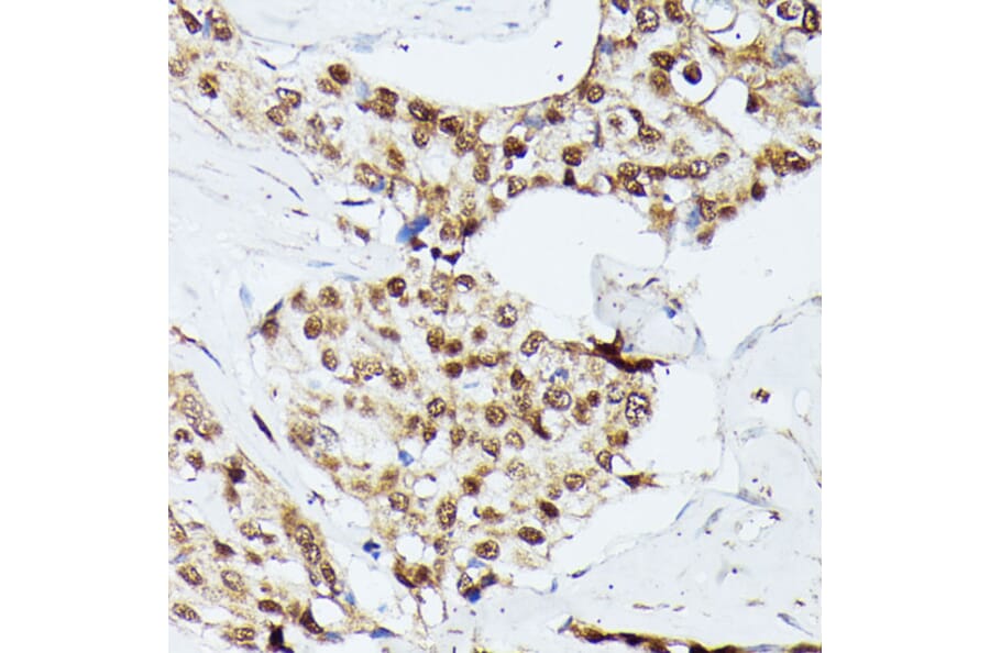 Immunohistochemistry - Anti-KIF22 Antibody (A91079) - Antibodies.com