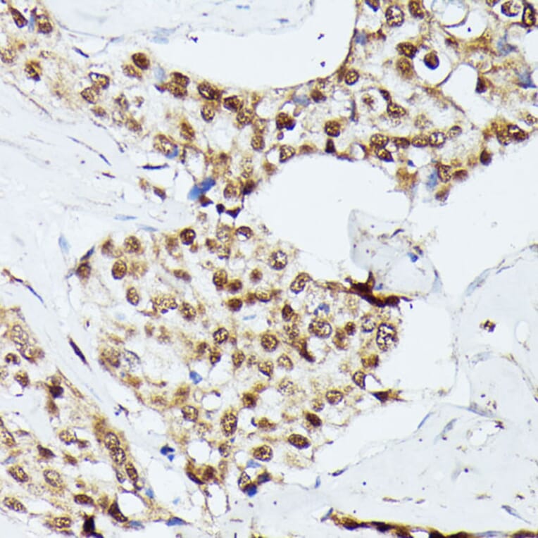 Immunohistochemistry - Anti-KIF22 Antibody (A91079) - Antibodies.com