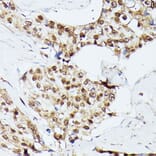 Immunohistochemistry - Anti-KIF22 Antibody (A91079) - Antibodies.com