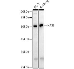 Western Blot - Anti-HAS3 Antibody (A91080) - Antibodies.com
