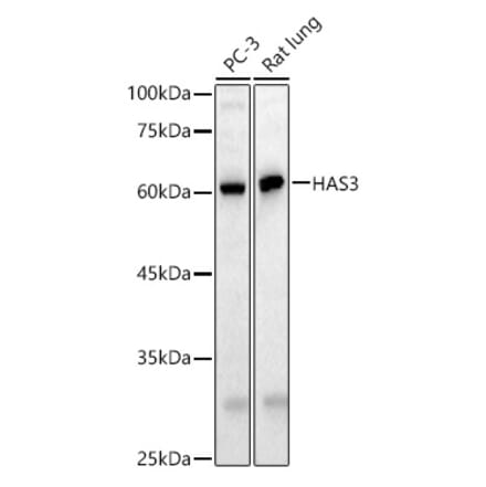 Western Blot - Anti-HAS3 Antibody (A91080) - Antibodies.com