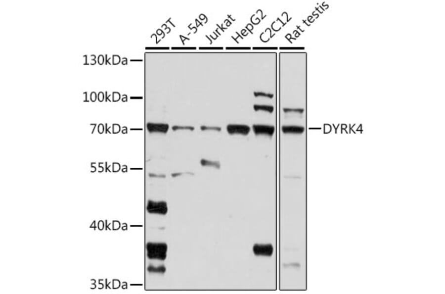 Western Blot - Anti-DYRK4 Antibody (A91081) - Antibodies.com
