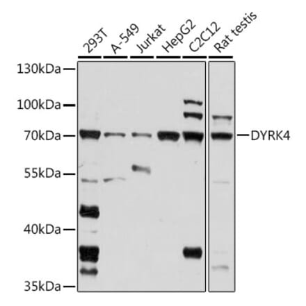 Western Blot - Anti-DYRK4 Antibody (A91081) - Antibodies.com