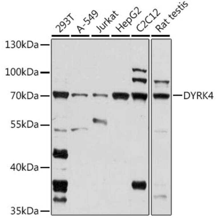 Western Blot - Anti-DYRK4 Antibody (A91081) - Antibodies.com