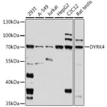 Western Blot - Anti-DYRK4 Antibody (A91081) - Antibodies.com