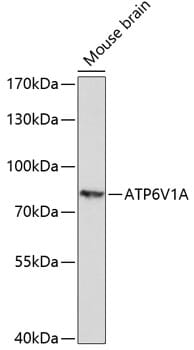 Western blot analysis of extracts of mouse brain , using Anti-ATP6V1A Antibody (A14707) at 1:1,000 dilution.
Secondary antibody: Goat Anti-Rabbit IgG (H+L) (HRP) (AS014) at 1:10,000 dilution.
Lysates / proteins: 25µg per lane.
Blocking buffer: 3% non-fat dry milk in TBST.
Detection: ECL Enhanced Kit (RM00021).
Exposure time: 3min.