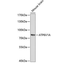 Western Blot - Anti-ATP6V1A Antibody (A91082) - Antibodies.com