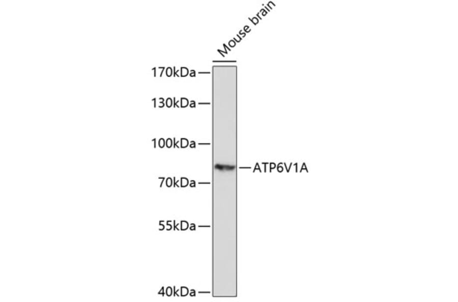 Western Blot - Anti-ATP6V1A Antibody (A91082) - Antibodies.com