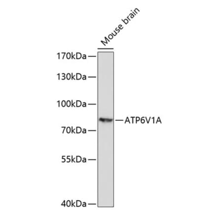 Western Blot - Anti-ATP6V1A Antibody (A91082) - Antibodies.com