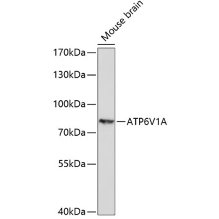 Western Blot - Anti-ATP6V1A Antibody (A91082) - Antibodies.com