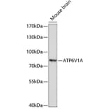 Western Blot - Anti-ATP6V1A Antibody (A91082) - Antibodies.com