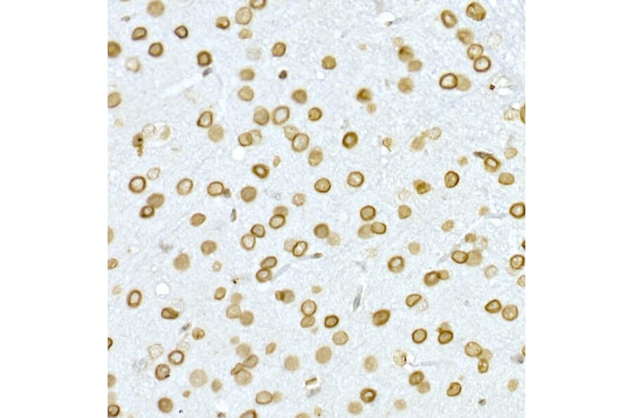 Immunohistochemistry - Anti-Lamin A Antibody (A91083) - Antibodies.com