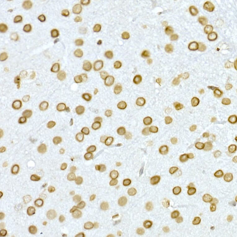 Immunohistochemistry - Anti-Lamin A Antibody (A91083) - Antibodies.com