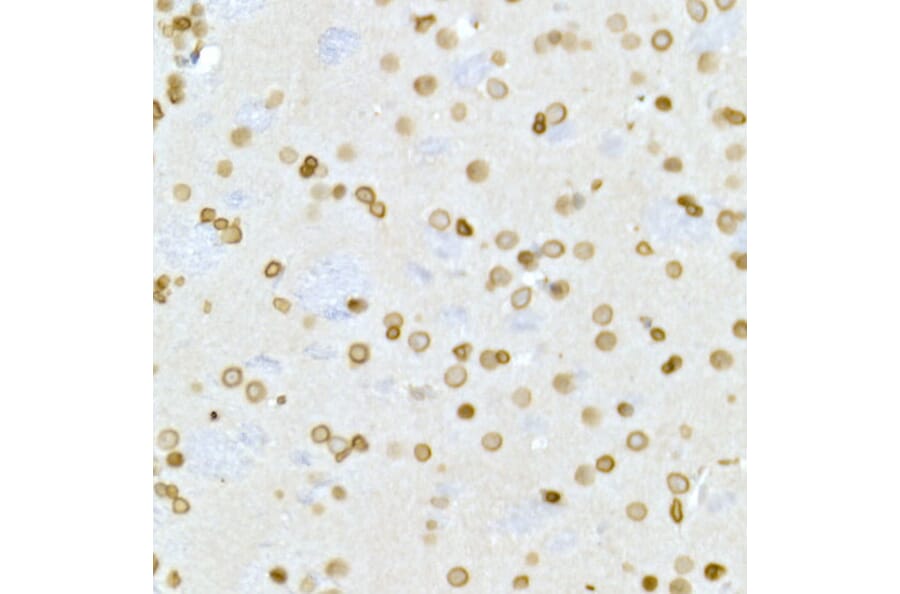 Immunohistochemistry - Anti-Lamin A Antibody (A91083) - Antibodies.com