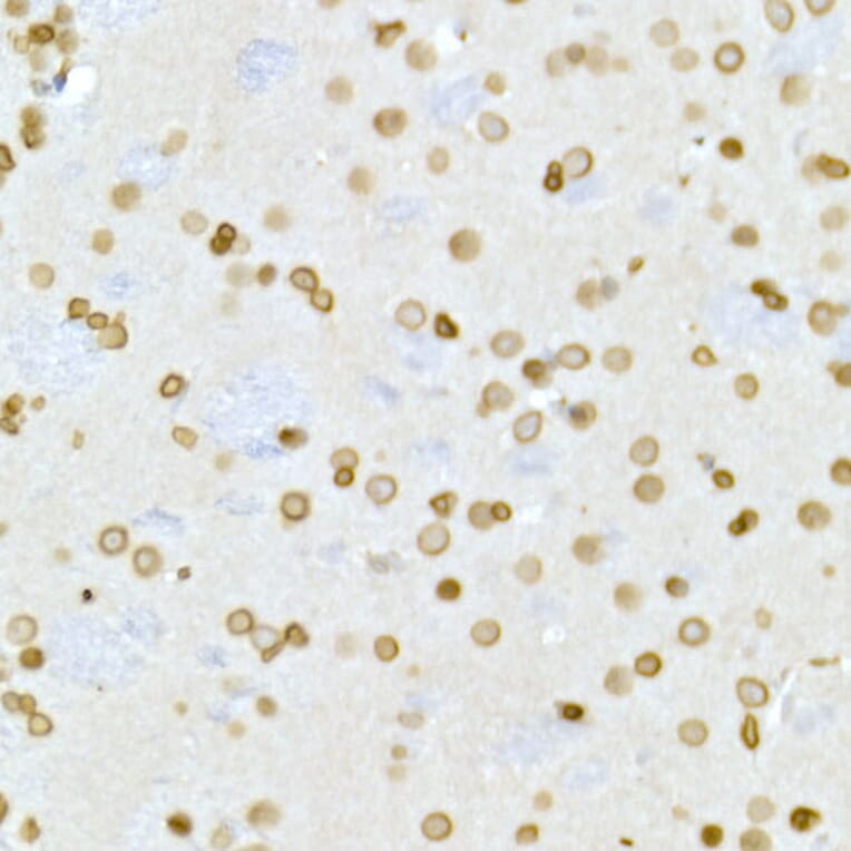 Immunohistochemistry - Anti-Lamin A Antibody (A91083) - Antibodies.com