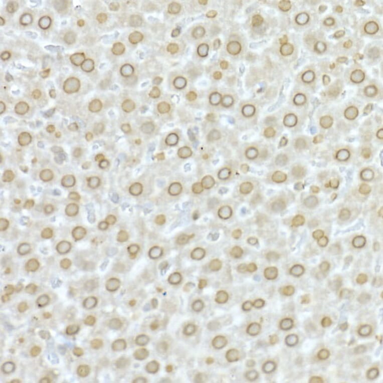 Immunohistochemistry - Anti-Lamin A Antibody (A91083) - Antibodies.com