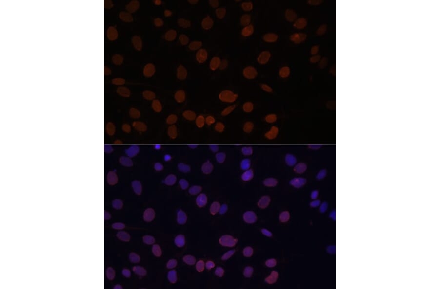 Immunofluorescence - Anti-Lamin A Antibody (A91083) - Antibodies.com