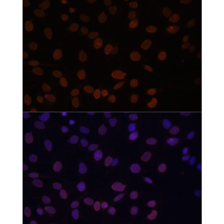 Immunofluorescence - Anti-Lamin A Antibody (A91083) - Antibodies.com