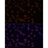 Immunofluorescence - Anti-Lamin A Antibody (A91083) - Antibodies.com