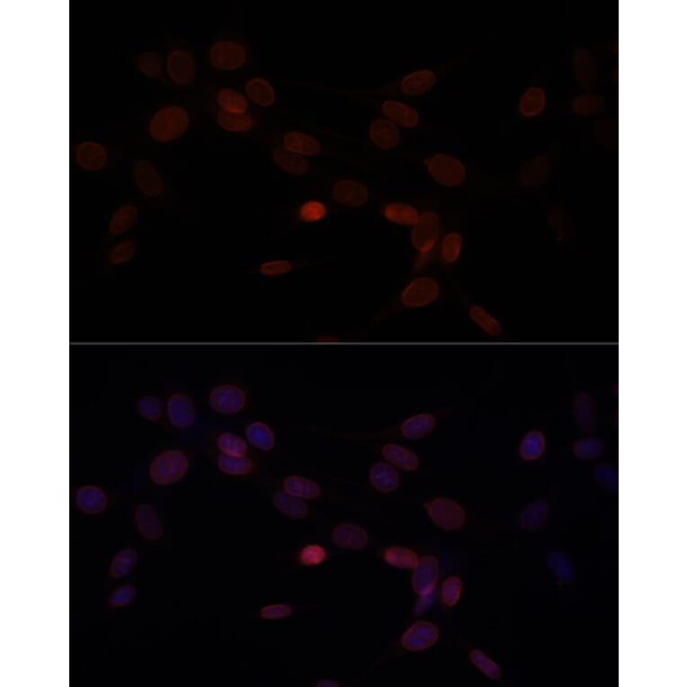 Immunofluorescence - Anti-Lamin A Antibody (A91083) - Antibodies.com