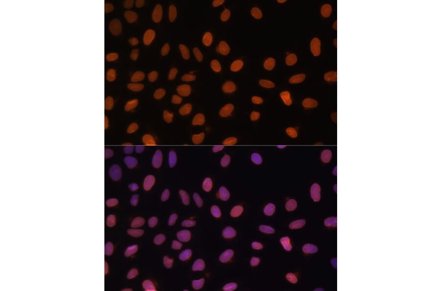 Immunofluorescence - Anti-Lamin A Antibody (A91083) - Antibodies.com