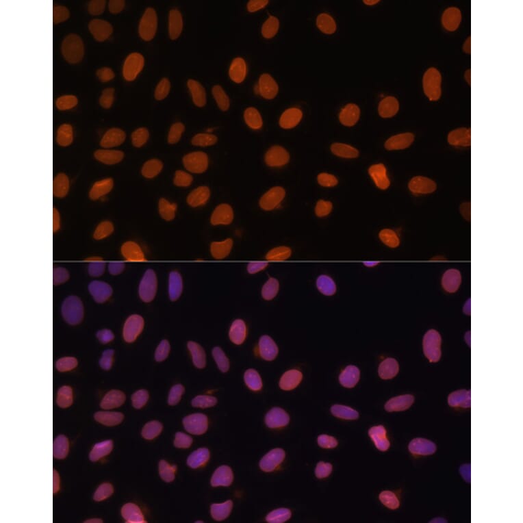 Immunofluorescence - Anti-Lamin A Antibody (A91083) - Antibodies.com