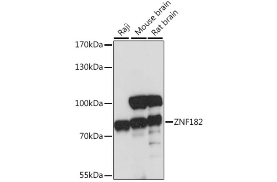 Western Blot - Anti-ZNF182 Antibody (A91085) - Antibodies.com