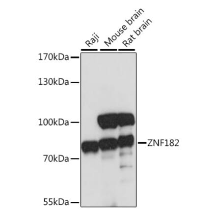 Western Blot - Anti-ZNF182 Antibody (A91085) - Antibodies.com