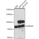 Western Blot - Anti-ZNF182 Antibody (A91085) - Antibodies.com