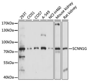 Western Blot - Anti-SCNN1G Antibody (A91086) - Antibodies.com