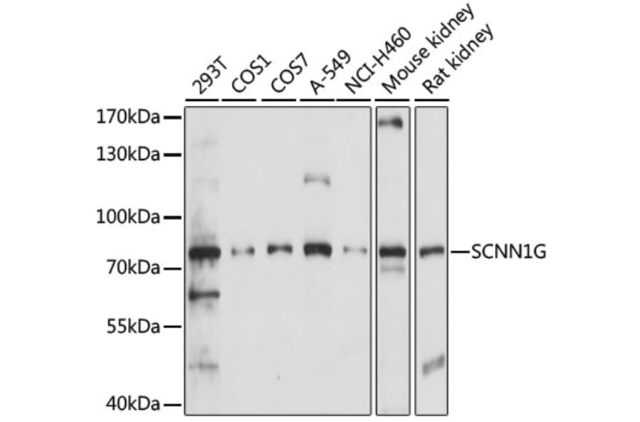 Western Blot - Anti-SCNN1G Antibody (A91086) - Antibodies.com