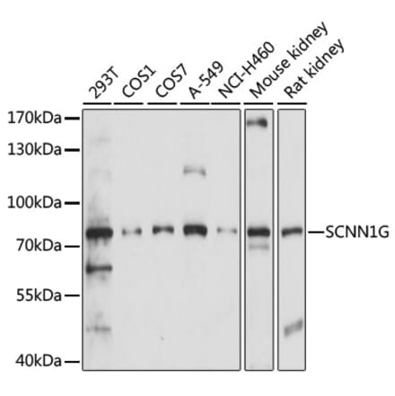 Western Blot - Anti-SCNN1G Antibody (A91086) - Antibodies.com