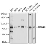 Western Blot - Anti-SCNN1G Antibody (A91086) - Antibodies.com