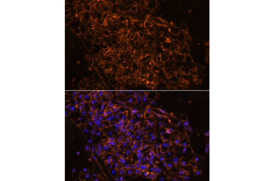 Immunofluorescence - Anti-SCNN1G Antibody (A91086) - Antibodies.com