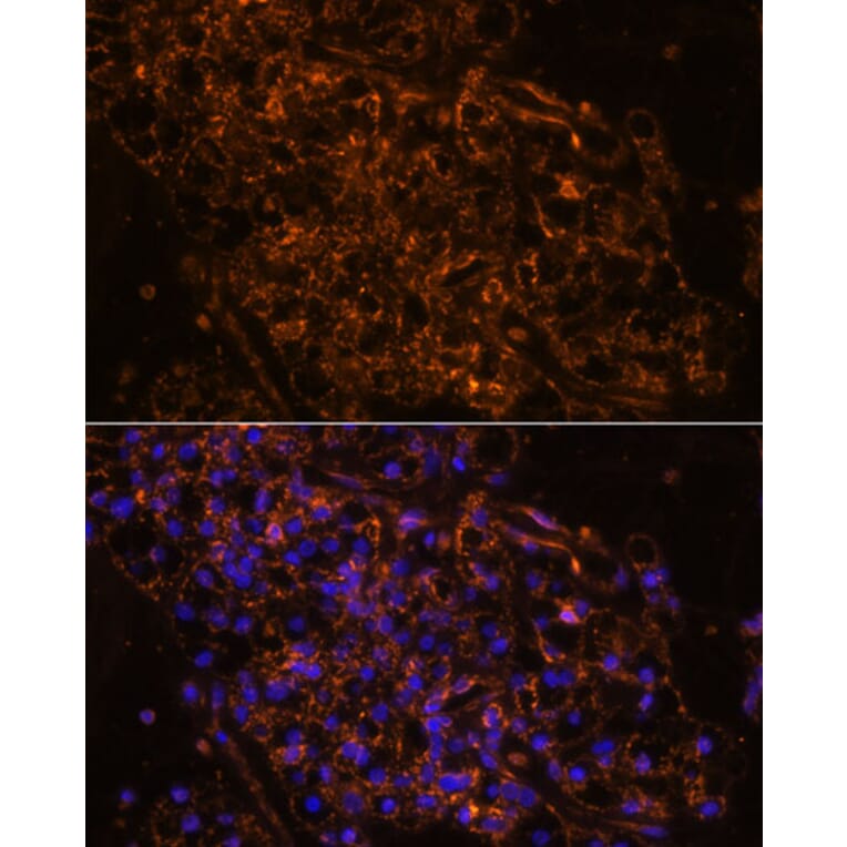 Immunofluorescence - Anti-SCNN1G Antibody (A91086) - Antibodies.com