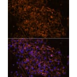 Immunofluorescence - Anti-SCNN1G Antibody (A91086) - Antibodies.com