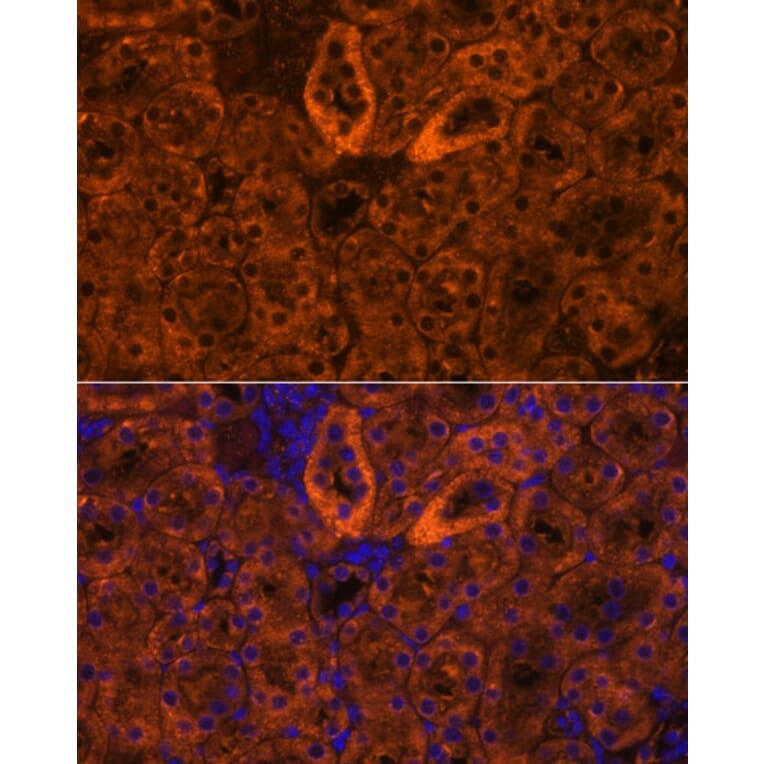 Immunofluorescence - Anti-SCNN1G Antibody (A91086) - Antibodies.com