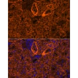 Immunofluorescence - Anti-SCNN1G Antibody (A91086) - Antibodies.com