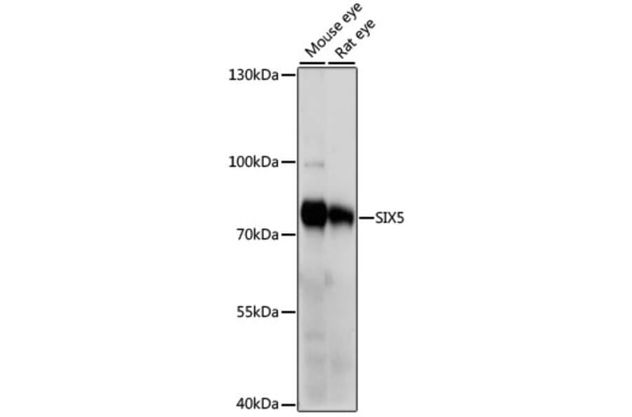 Western Blot - Anti-SIX5 Antibody (A91087) - Antibodies.com