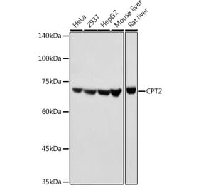 Western Blot - Anti-CPT2 Antibody (A91088) - Antibodies.com