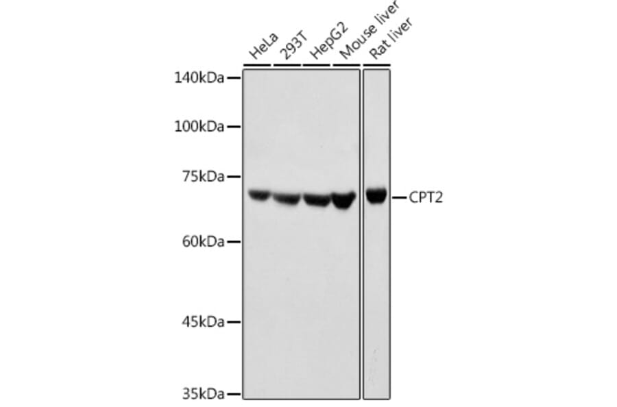 Western Blot - Anti-CPT2 Antibody (A91088) - Antibodies.com