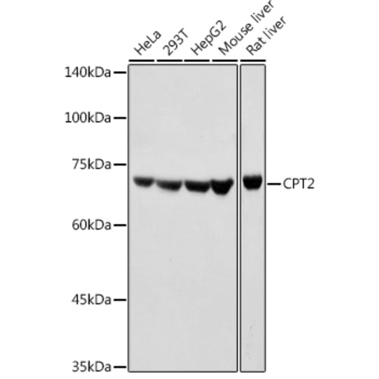 Western Blot - Anti-CPT2 Antibody (A91088) - Antibodies.com