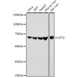 Western Blot - Anti-CPT2 Antibody (A91088) - Antibodies.com