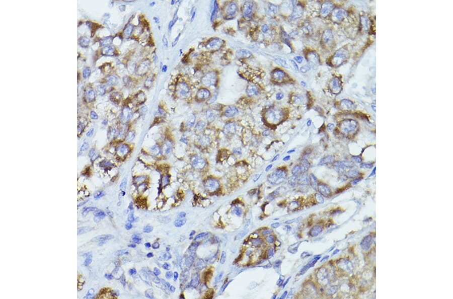 Immunohistochemistry - Anti-CPT2 Antibody (A91088) - Antibodies.com