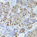 Immunohistochemistry - Anti-CPT2 Antibody (A91088) - Antibodies.com