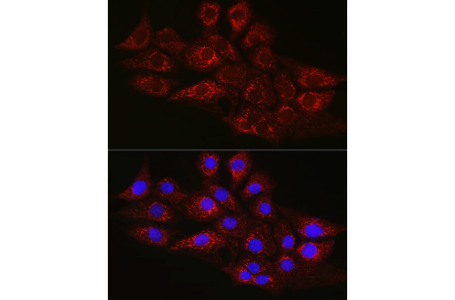 Immunofluorescence - Anti-CPT2 Antibody (A91088) - Antibodies.com