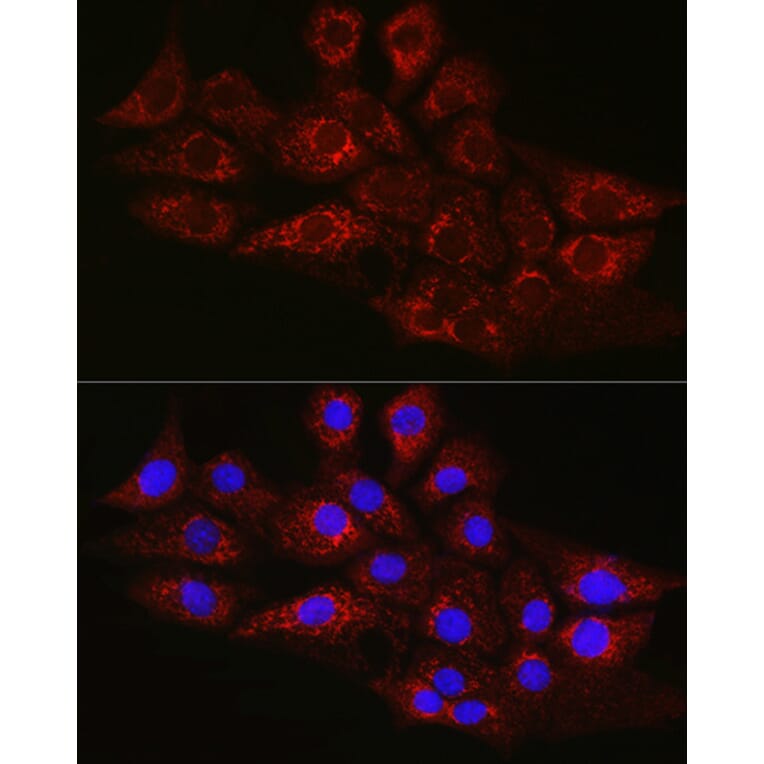 Immunofluorescence - Anti-CPT2 Antibody (A91088) - Antibodies.com